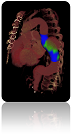 Virtual Stenting Thorax